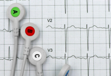 Close up of heart monitor equipment